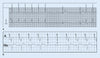 LevMed AllBrand 12 Lead ECG